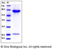 Sino Biological Recombinant Rat PCSK9 Protein (His Tag), Quantity: Each