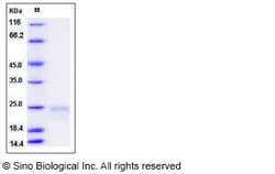 Sino Biological VEGF164 Protein, Rat, Recombinant, Quantity: Each of 1