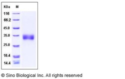 Sino Biological Recombinant Rat SOST/Sclerostin Protein (His Tag), Quantity: