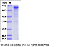 Sino Biological Rat DLL1 Protein (Fc Tag) 100ug, Quantity: Each of 1