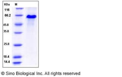 Sino Biological Recombinant Rat DLL1 Protein (His Tag), Quantity: Each