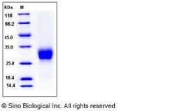 Sino Biological Recombinant Rat CD16a/FCGR3A/Fc gamma RIIIA Protein (His