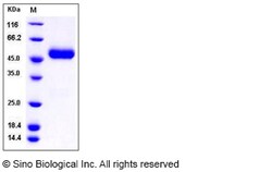 Sino Biological Recombinant Rat CNTFR Protein (His Tag), Quantity: Each