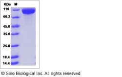 Sino Biological Recombinant Rat ICAM-1/CD54 Protein (hFc Tag), HPLC-verified,