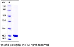 Sino Biological Recombinant Rat IL-1 beta Protein (mature form), Quantity:
