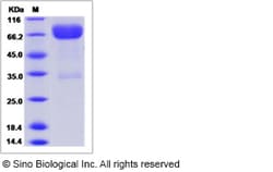 Sino Biological Recombinant Rat B7-1/CD80 Protein (ECD, hFc Tag), Quantity: