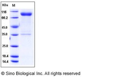 Sino Biological Recombinant Rat IL1R1 Protein (His & mFc Tag), Quantity: