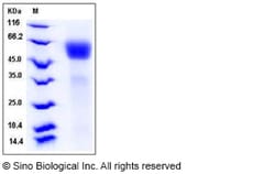 Sino Biological Recombinant Rat IL1R1 Protein (His Tag), HPLC-verified,