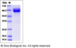Sino Biological Recombinant Rat Growth Hormone Receptor Protein (hFc Tag),