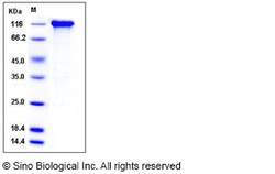 Sino Biological Recombinant Rat gp130/IL6ST Protein (His & mFc Tag), Quantity:
