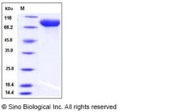 Sino Biological Recombinant Rat gp130/IL6ST Protein (His Tag), Quantity: