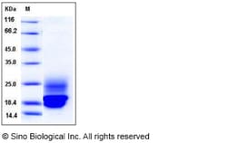 Sino Biological Recombinant Rat Cystatin C Protein (His Tag), Quantity: