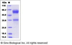 Sino Biological Recombinant Rat Fas/CD95/TNFRSF6 Protein (hFc Tag), HPLC-verified,