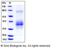 Sino Biological Recombinant Rat Fas/CD95/TNFRSF6 Protein (His Tag), Quantity: