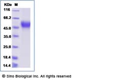 Sino Biological Recombinant Rat L-selectin/CD62L Protein (His Tag), Quantity: