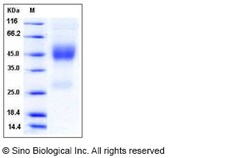 Sino Biological Rat Neurexophilin-1 / NXPH1 Protein (His Tag) 100ug, Quantity: