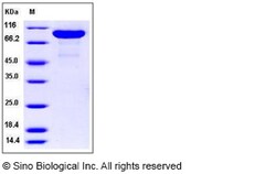 Sino Biological Rat MMP-9 / CLG4B Protein (His Tag) 50ug, Quantity: Each