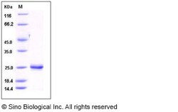 Sino Biological Recombinant Rat Lipocalin-2/NGAL Protein (His Tag), HPLC-verified,