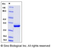 Sino Biological Recombinant Rat Serum Amyloid P Protein (His Tag), Quantity: