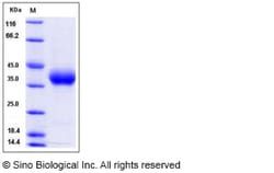 Sino Biological Rat PRLR / Prolactin receptor Protein (His Tag) 100ug,