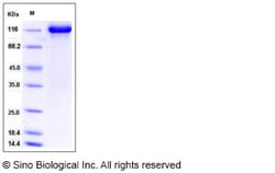 Sino Biological Recombinant Rat TIE-2 Protein (hFc Tag), Quantity: Each