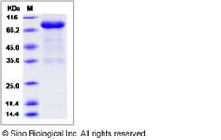 Sino Biological Recombinant Rat UNC5H2/UNC5B Protein (hFc Tag), Quantity: