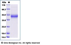 Sino Biological Recombinant Rat CD25/IL-2R alpha Protein (His Tag), HPLC-verified,