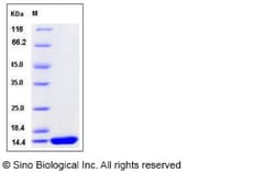 Sino Biological Recombinant Rat IL-2 Protein, Quantity: Each of 1