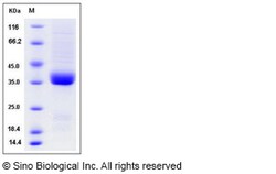 Sino Biological Recombinant Rat IL9R Protein (His Tag), Quantity: Each