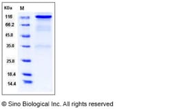 Sino Biological Recombinant Rat Her2/ERBB2 Protein (hFc Tag), Quantity: