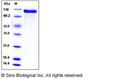 Sino Biological Recombinant Rat Her2/ERBB2 Protein (ECD, His Tag), HPLC-verified,