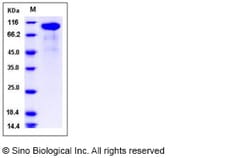 Sino Biological Rat HER2 / ErbB2 Protein 50ug, Quantity: Each of 1