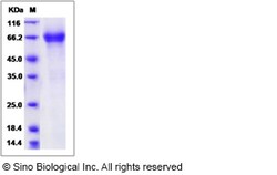 Sino Biological Recombinant Rat IL-7R alpha/CD127 Protein (mFc Tag), Quantity: