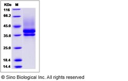 Sino Biological Rat IL7R / IL7RA Protein (His Tag) 100ug, Quantity: Each