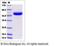 Sino Biological Recombinant Rat CD4 Protein (His Tag), HPLC-verified, Quantity: