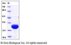 Sino Biological Rat UCHL3 Protein (His Tag) 50ug, Quantity: Each of 1