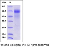 Sino Biological Rat FGFR4 / FGF Receptor 4 Protein (His Tag) 100ug, Quantity: