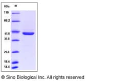 Sino Biological Recombinant Rat Pepsinogen C/PGC Protein (His Tag), Quantity: