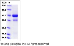 Sino Biological Mouse / Rat VEGFC / VEGF-C Protein (aa 108-223, Fc Tag)