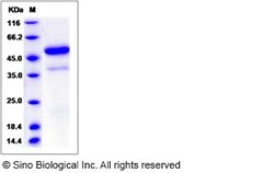 Sino Biological Rat VEGF-D / VEGFD / FIGF Protein (Fc Tag) 50ug, Quantity:
