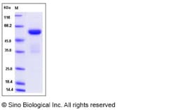 Sino Biological Recombinant Rat Ephrin A5 Protein (hFc Tag), Quantity: