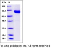 Sino Biological Recombinant Rat Ephrin-B1 Protein (hFc Tag), Quantity: