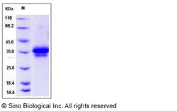 Sino Biological Recombinant Rat Ephrin-B1 Protein (His Tag), Quantity:
