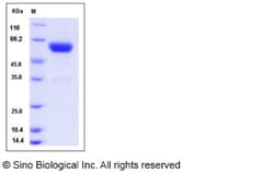 Sino Biological Recombinant Rat Ephrin B2 Protein (hFc Tag), Quantity: