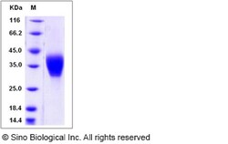 Sino Biological Rat Ephrin-B2 / EFNB2 Protein (His Tag) 200ug, Quantity: