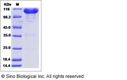 Sino Biological Recombinant Rat EphA7 Protein (hFc Tag), Quantity: Each