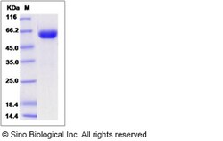 Sino Biological Rat EphA7 / EHK3 Protein (His Tag) 200ug, Quantity: Each