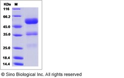 Sino Biological Recombinant Rat Ephrin A2/EFNA2 Protein (hFc Tag), Quantity: