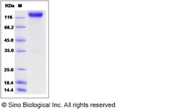 Sino Biological Recombinant Rat VEGFR2/KDR Protein (hFc Tag), Quantity:
