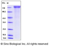 Sino Biological Rat VEGFR2 / Flk-1 / CD309 / KDR Protein (His Tag) 50ug,